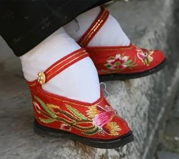 古代傳統極端纏足文化照片，X光看起來太可怕！